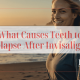 What Causes Teeth to Relapse after Invisalign