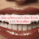 Prevent Yellow Teeth with Invisalign - GoToBro