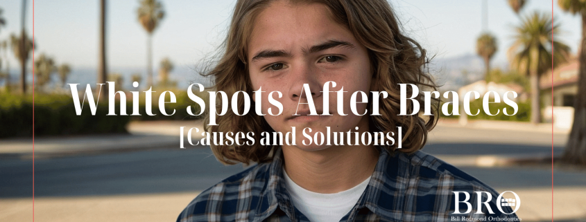 White Spots After Braces - Bill Redmond Orthodontics