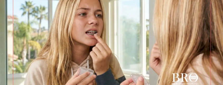 Broken Braces Wire Poking Cheek - GoToBro